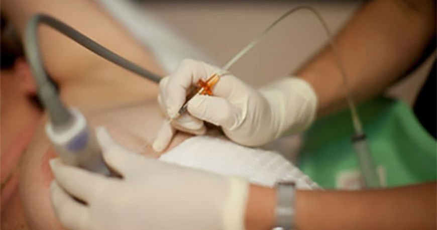 Процедура биопсии. Процедура биопсии.