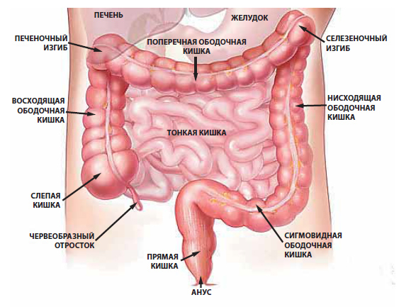 Колоректальный рак Колоректальный рак