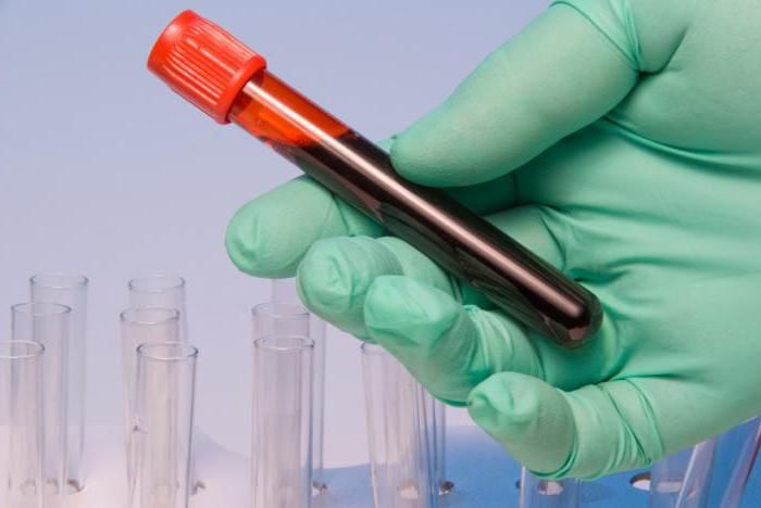 рэа онкомаркер - кровь в пробирке рэа онкомаркер - кровь в пробирке