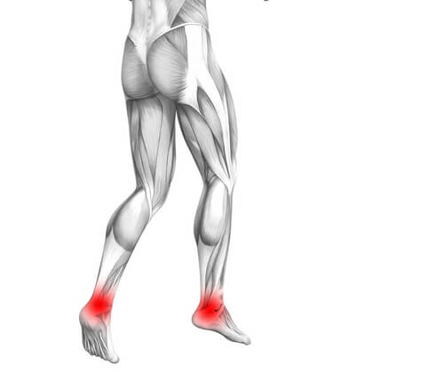 Лечение саркомы в Израиле