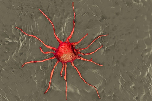 Лечение лейкемии в Израиле: современные методы, быстрое наступление ремиссии