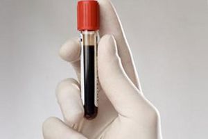 пробирка с кровью пробирка с кровью