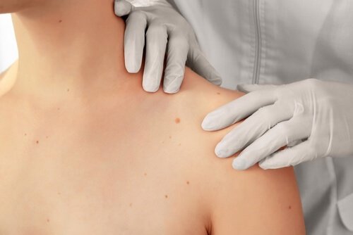 Лечение карциномы в Израиле: современные методы, 100% результат