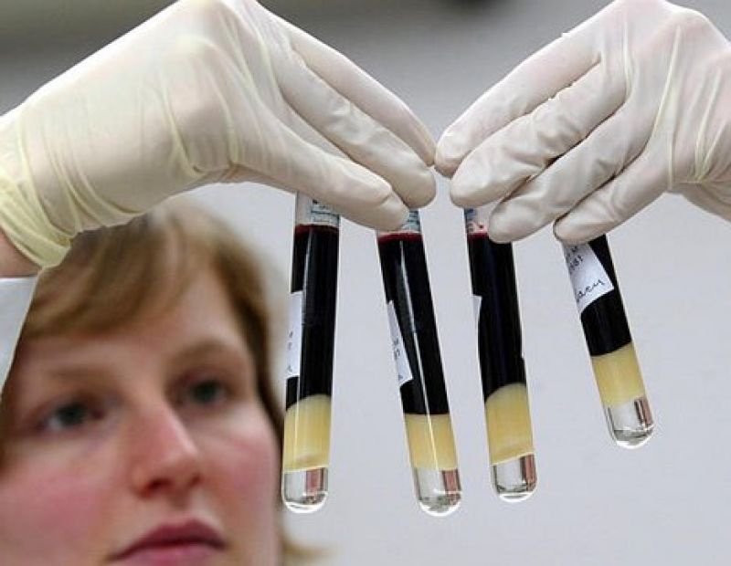 Тестирование для выявления СПИДа Тестирование для выявления СПИДа