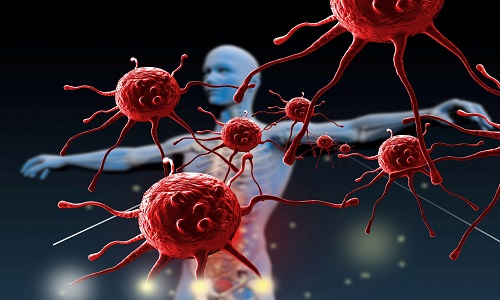 Проблема вторичного иммунодефицита Проблема вторичного иммунодефицита