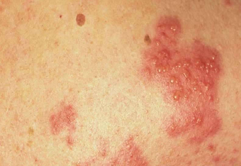 Потница Потница