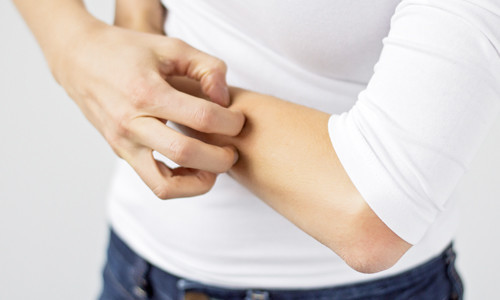 Проблема аллергии Проблема аллергии