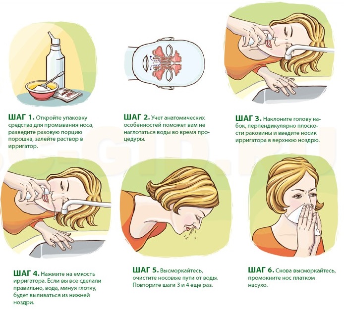 Промывание носа для устранения заложенности носа при аллергии Промывание носа для устранения заложенности носа при аллергии