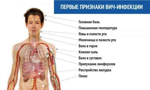 Первые симптомы ВИЧ-инфекции Первые симптомы ВИЧ-инфекции