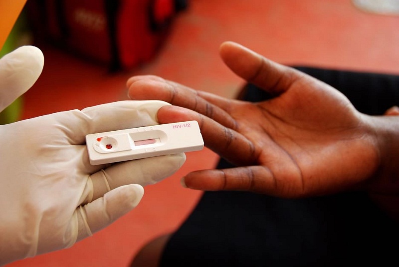 Диагностика ВИЧ-инфекции с помощью теста Диагностика ВИЧ-инфекции с помощью теста