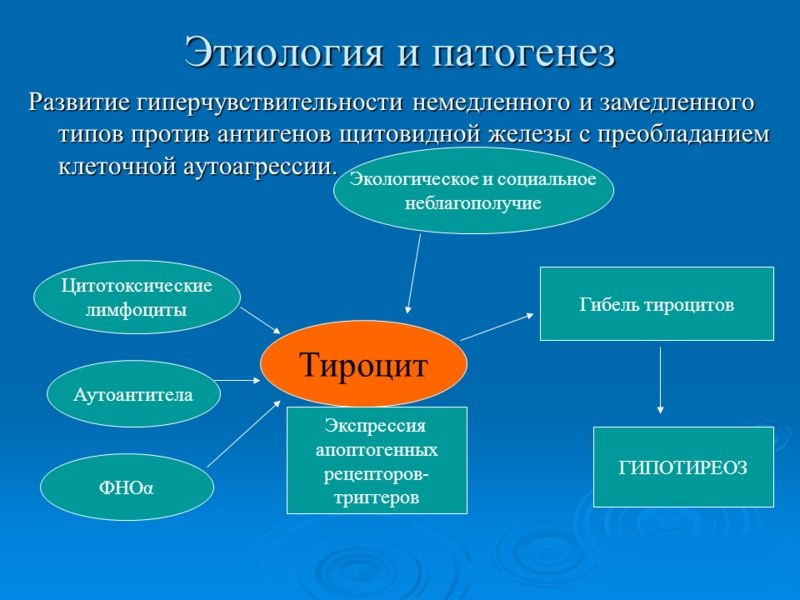Тиреоидит Тиреоидит