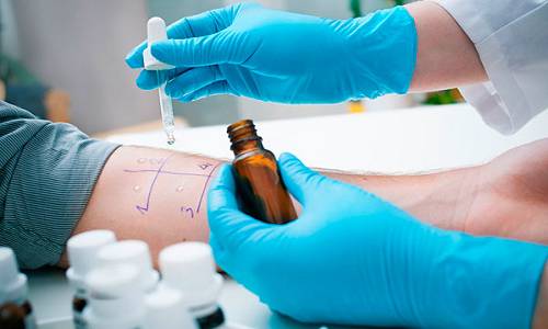 Проведение пробы на аллергию Проведение пробы на аллергию